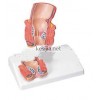 人体解剖模型-痔疮模型，标准