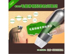 台湾正版CBS-1600T毛发移植检测仪