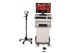 光學電子陰道鏡