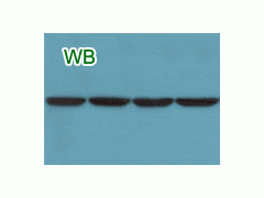 代做免疫印迹Western Blot实验
