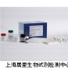 人TBAELISA报价