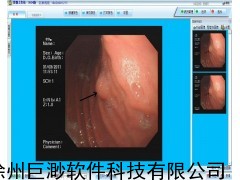 内窥镜影像工作站软件,内窥镜影像工作站
