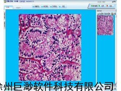 病理图文报告系统，病理图文工作站，病理报告软件