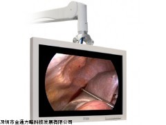 FSN24寸医疗显示器 FS-L2402D史塞克原厂显示器