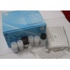 人泛醌蛋白1elisa kit