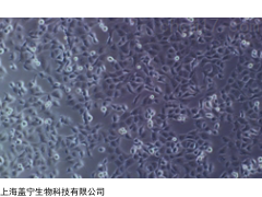 hFOB 1.19,人SV40轉(zhuǎn)染成骨細(xì)胞