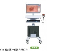 医用电子皮肤镜影像系统（简易版）