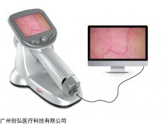 便携式电子皮肤镜