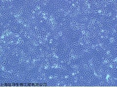HFLS-RA类风湿关节炎成纤维样滑膜细胞