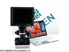 微循環(huán)檢測儀，微循環(huán)檢測儀價格
