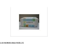人蛋白Z依賴性蛋白酶抑制因子(ZPI)檢測試劑盒