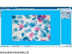 液基薄层细胞学检测系统 TBS TCT液基图文报告系统软件