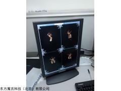 医学影像远程会诊显示器，影像会诊显示器