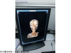 联影影像设备专用显示器，医用灰阶竖屏 ，医用竖屏