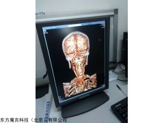 4MP诊断显示器，双屏阅片显示器，竖屏显示器