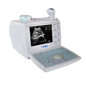 便携黑白B超价格，手持式，b超测定仪